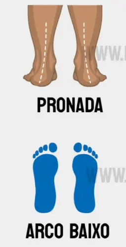 pisada pronada