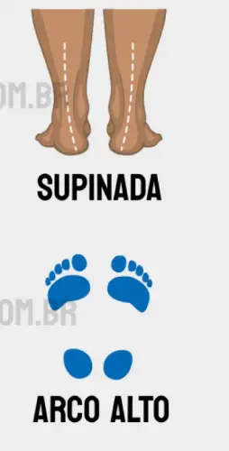 pisada supinada